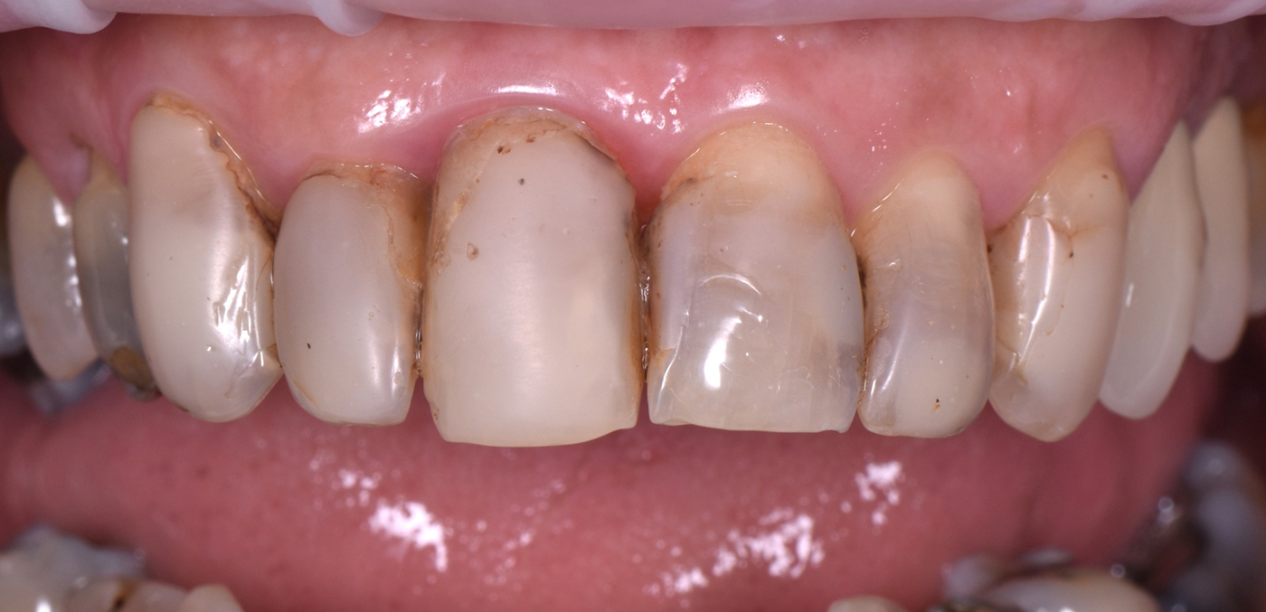 alt before image